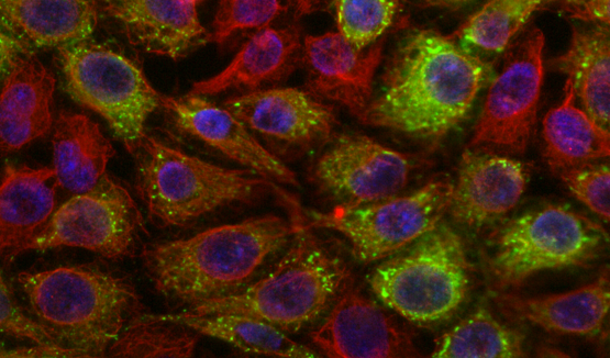 A microscope image showing the formation of sress granules in cells. Stress granules appear as bright regions (indicating high concentration of tagged proteins) against the background of the cytoplasm.